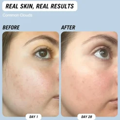 [Common Clouds] Cloud Water Gentle Exfoliating BHA Toner