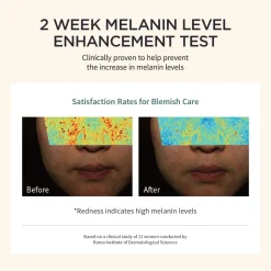 [Goodal] Green Tangerine Vita C Dark Spot Serum