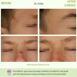 [iUNIK] Centella Calming AC Spot Cream